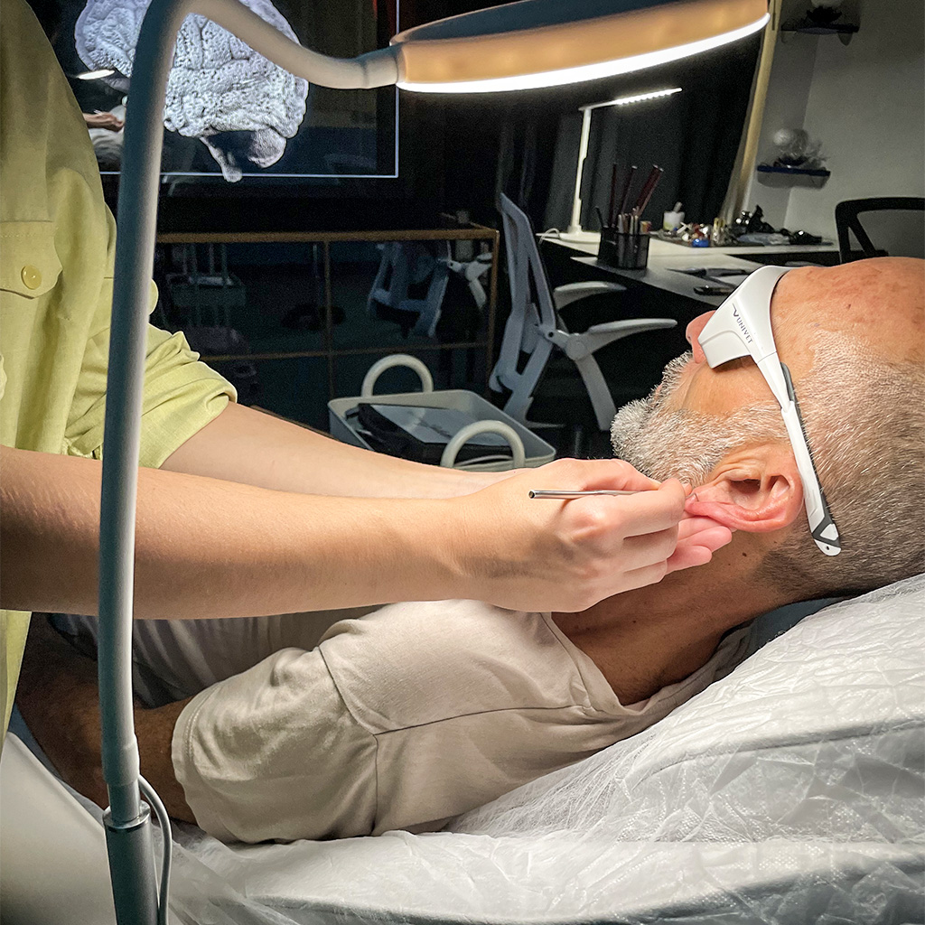 Application précise du laser doux sur l’oreille