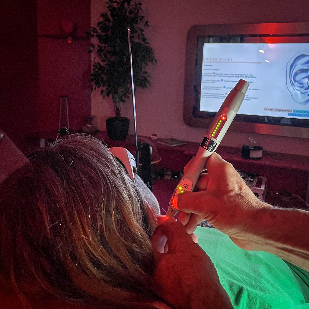 Laser doux utilisé avec cartographie auriculaire